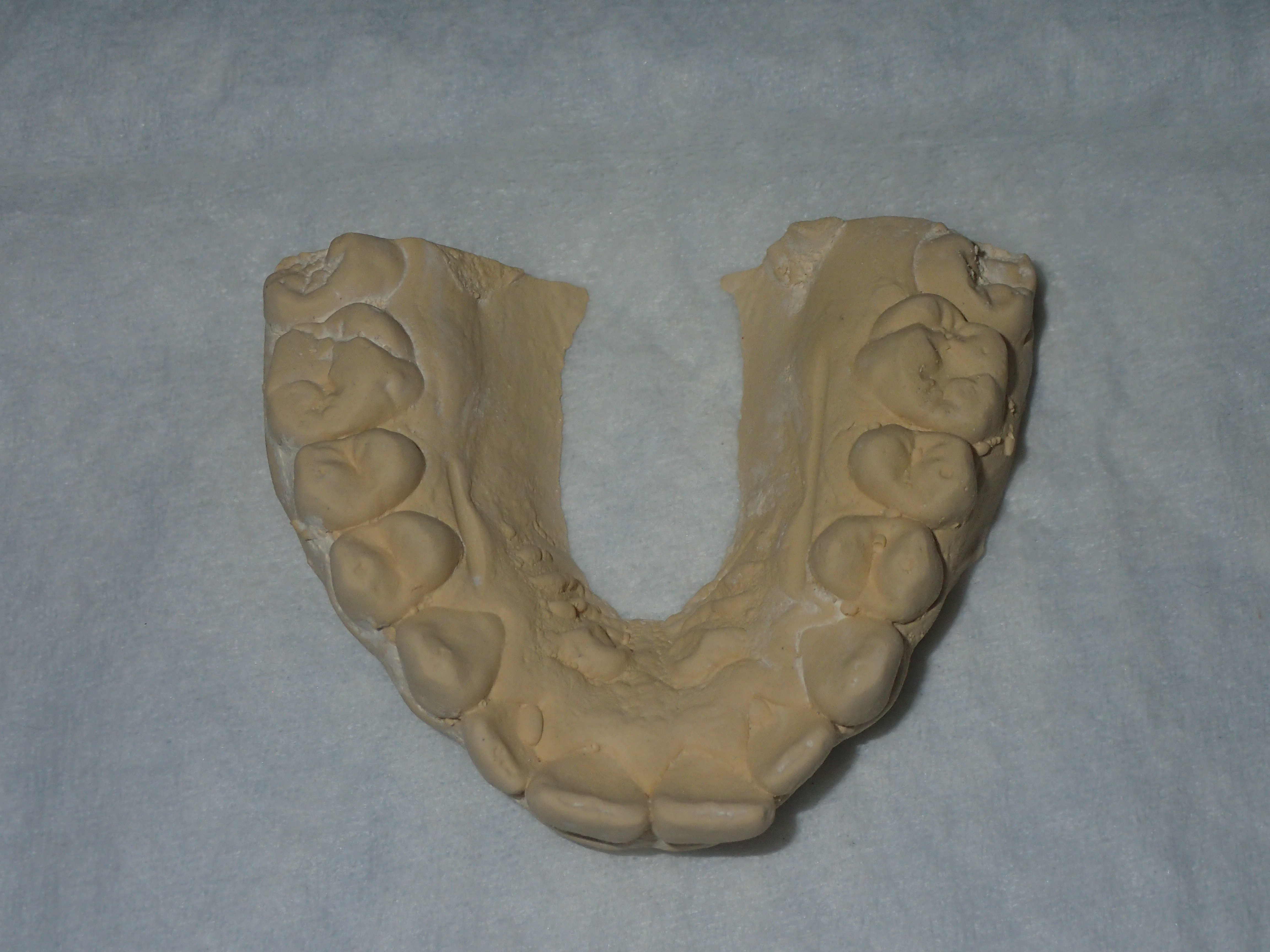 Dental Cast to be scanned for tooth movement