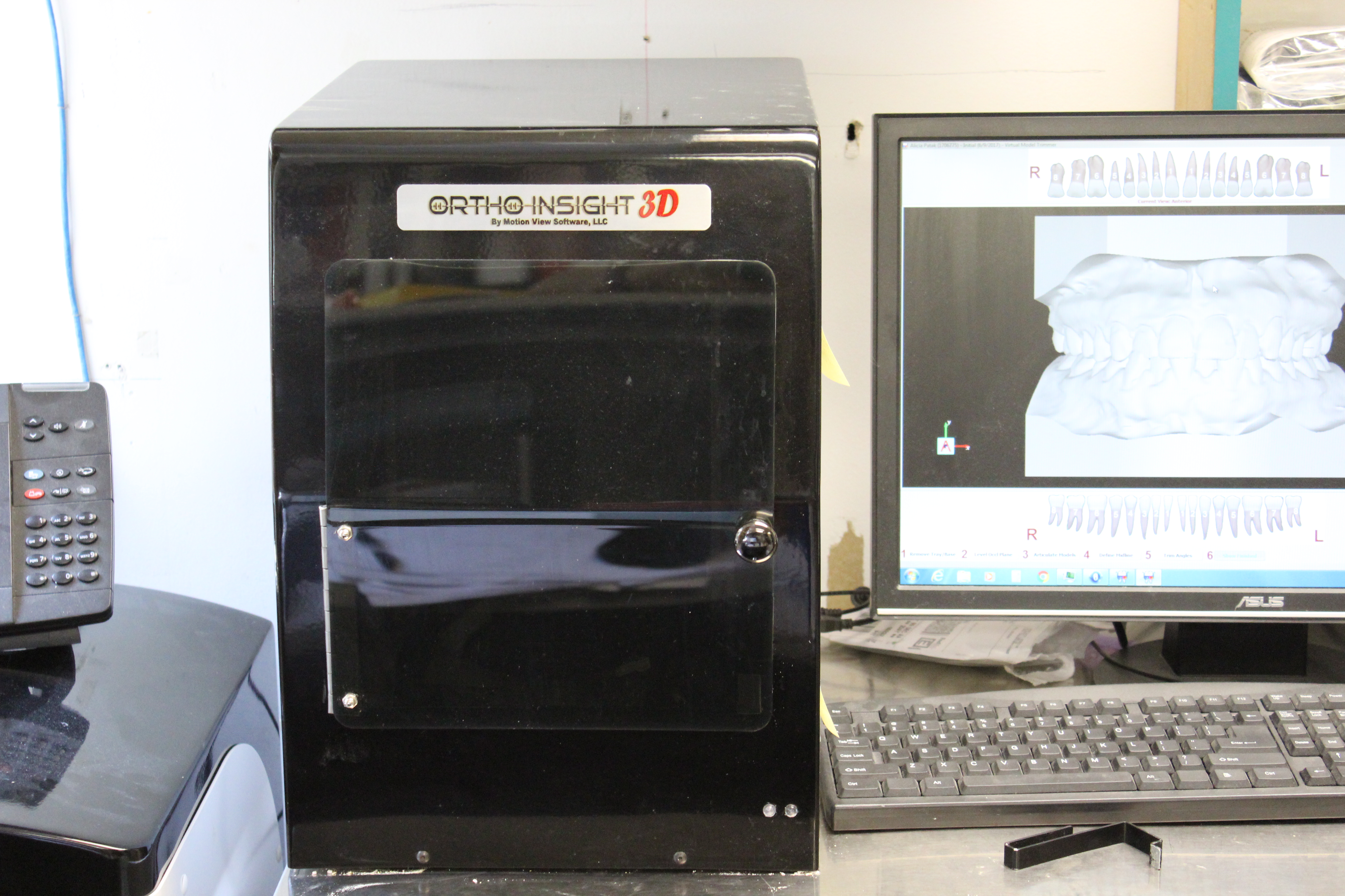 Ortho Insight 3D model scanner. Makes digital models from patients impression or dental cast