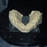 Cast placed in 3D scanner.  Laser will scan X,Y Z axis to generate 3 D model
