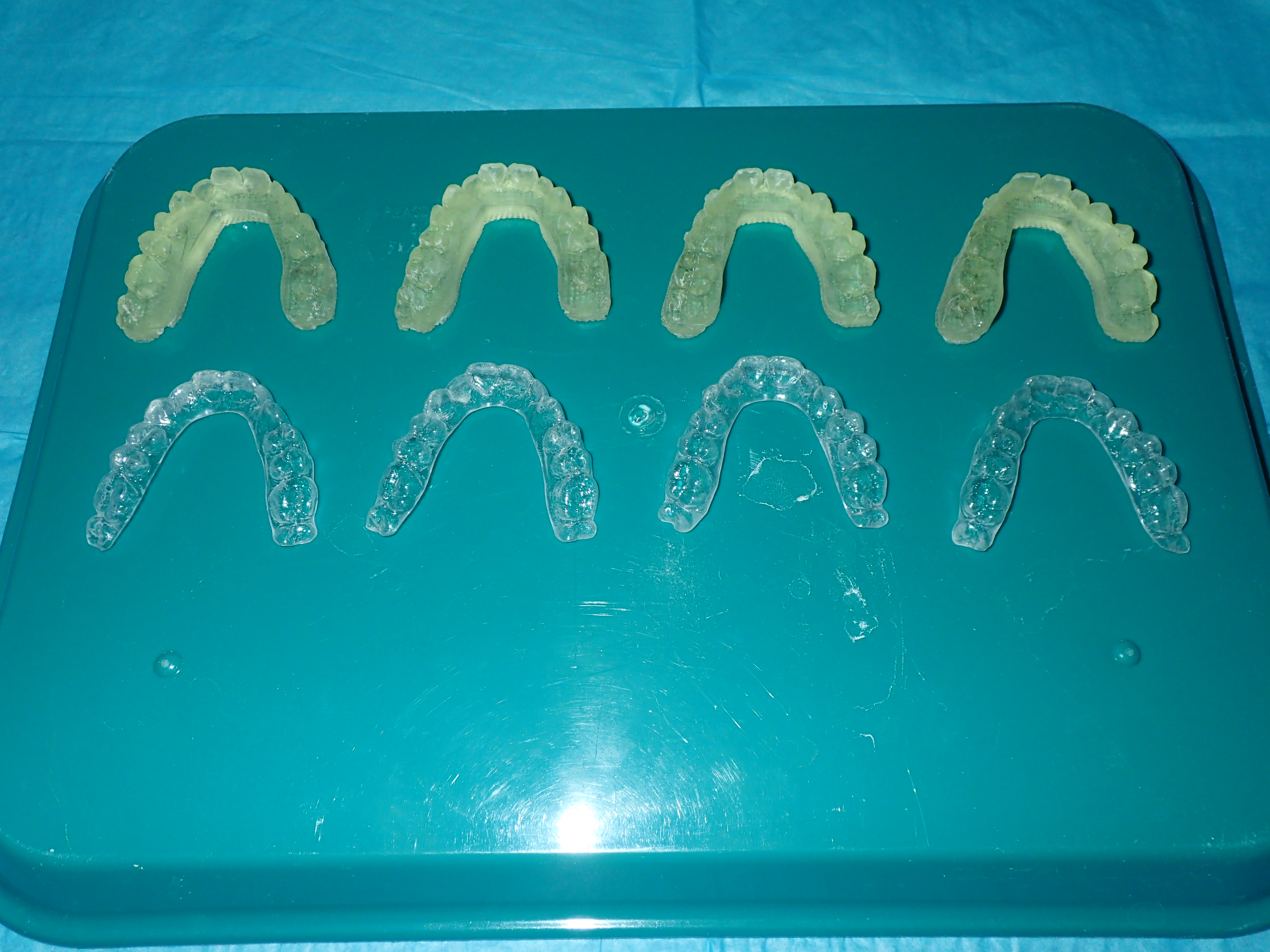 Aligners are made from 3 D printed models (with prescribed tooth movement) and trimmed and polished in preparation for delivery to the patient.